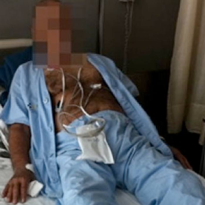 viagra penis amputated