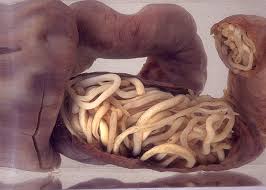 intestinal parasites
