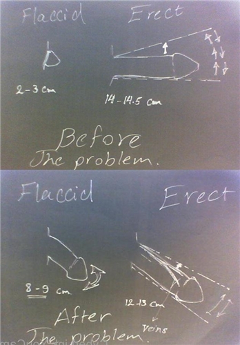 what is hard flaccid