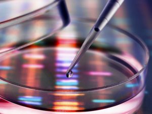 Sample of DNA being pipetted into a petri dish over genetic results Sample of DNA being pipetted into a petri dish over genetic results